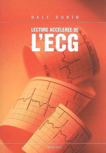 Lecture accélérée de l'ecg